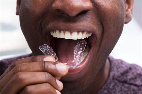 invisalign night guard cost.